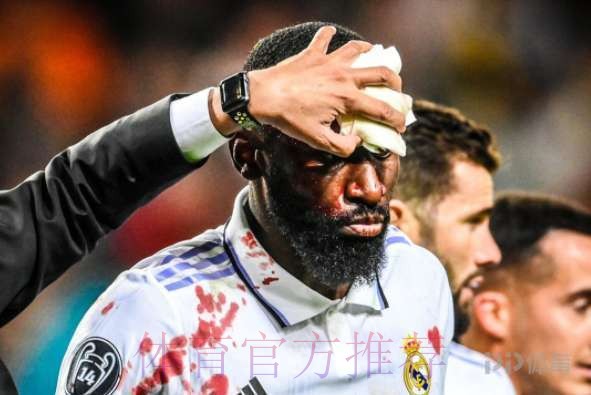 皇马正给吕迪格设计面具 若能睁右眼有望战巴萨 皇马正给吕迪格设计面具 若能睁右眼有望战巴萨